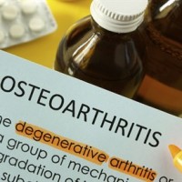 Osteoarthritis